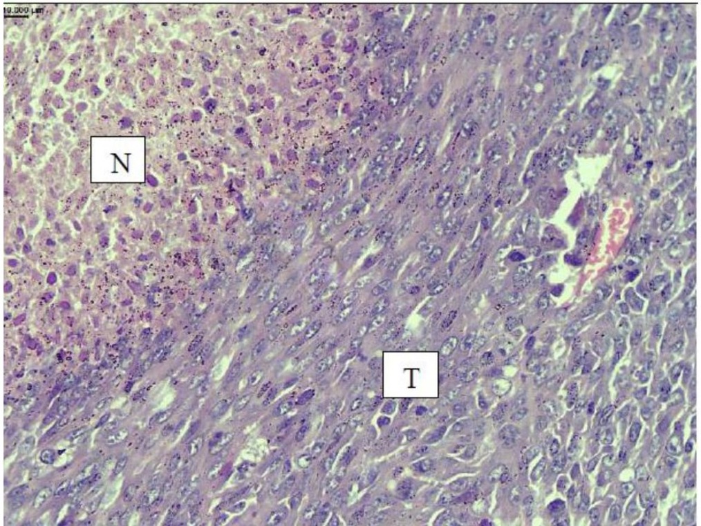 Group 3 — Radiation + RADSENPRO